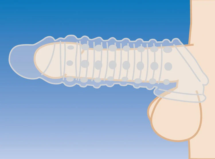 1.5" Enhancer Sleeve - Image 3